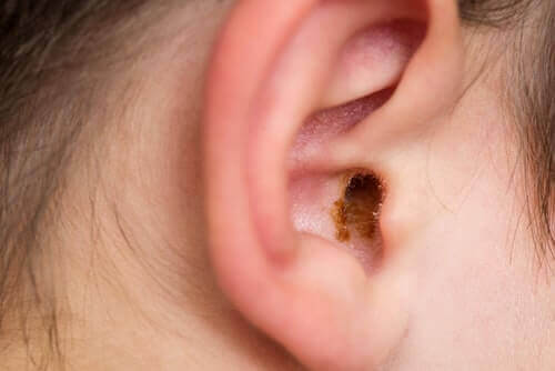 wax in ear